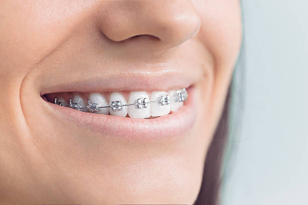 Best Veneers and Lumineers  in Gulfport, MS